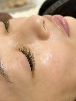 クロエ(Chloe)/お肌ピカピカフェイシャル WAX