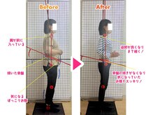 藤整体院 磐田見付院/痩身☆体重－１０ｋｇ達成