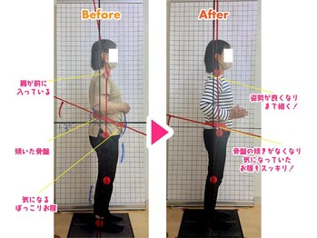 藤整体院 磐田見付院/痩身☆体重－１０ｋｇ達成