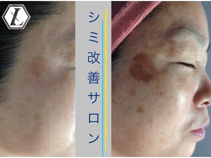 ルノン(LUNON)の写真