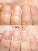 マリーロール 梅田店(Marie Laure)/深爪矯正/自爪育成/自爪風