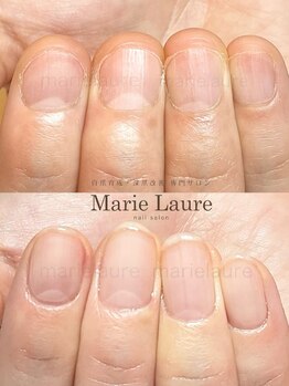 マリーロール 梅田店(Marie Laure)/深爪矯正/自爪育成/自爪風