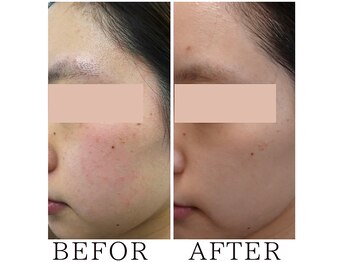 サロンドムーン(salon de MooN)/症例写真