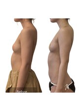 ベンザイ 梅田店(BENZAI)/美姿勢、姿勢改善