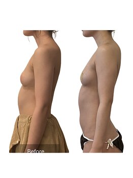 ベンザイ 梅田店(BENZAI)/美姿勢、姿勢改善