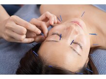 センコウ(SENKOU)