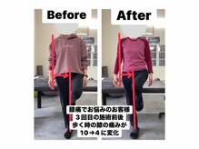 アンティオール 札幌店/70代女性　膝痛/変形性/半月板