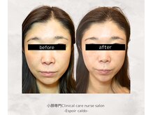 エスポワールカルド(Espoir caldo)/