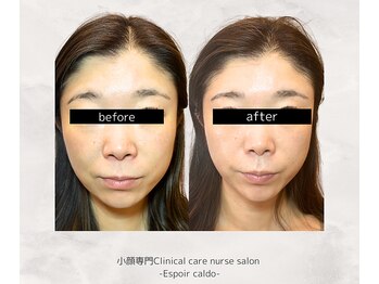 エスポワールカルド(Espoir caldo)/