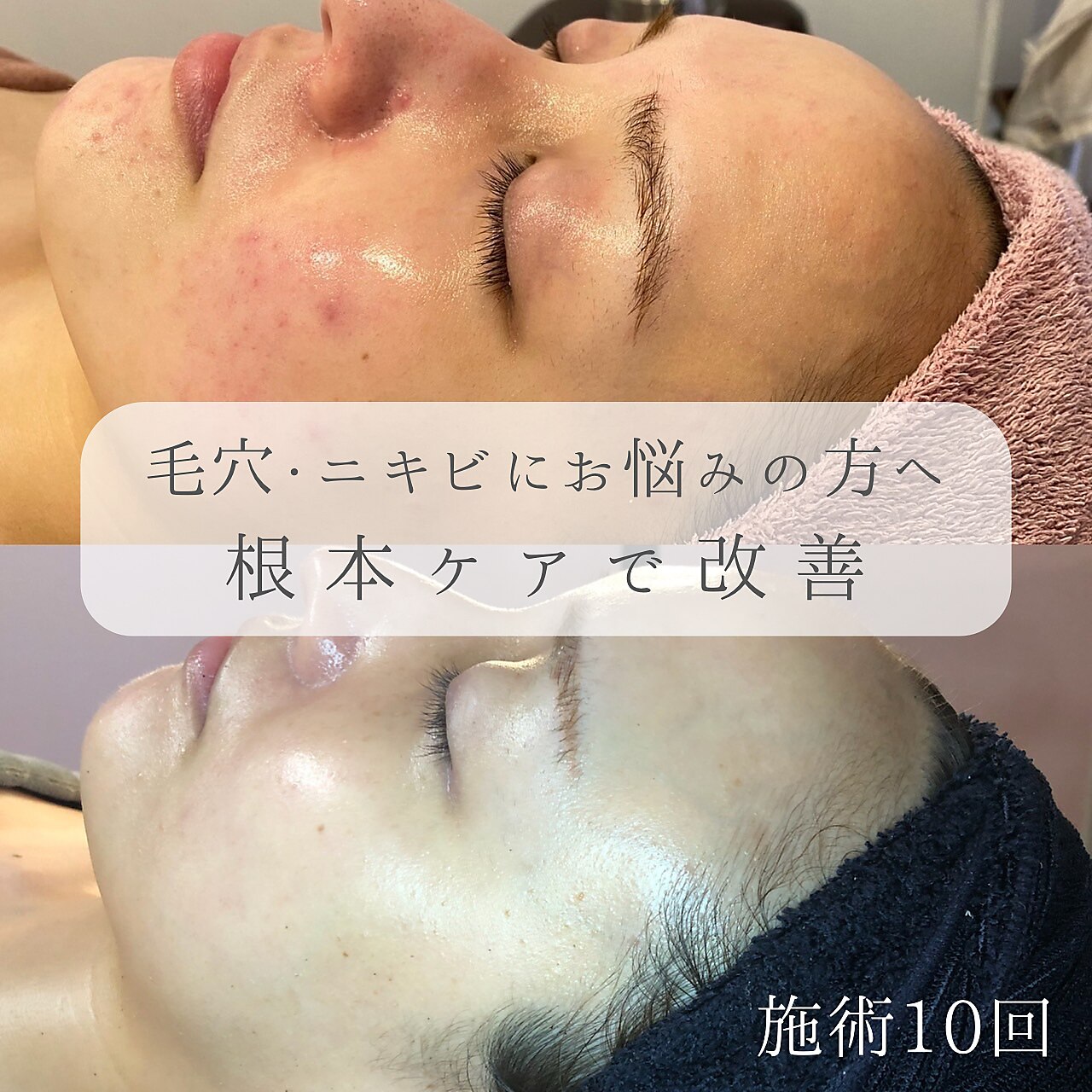 水島駅で美肌が人気のエステサロン｜ホットペッパービューティー