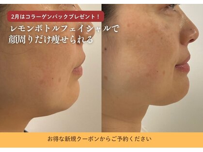 デディア 恵比寿(dedia)の写真