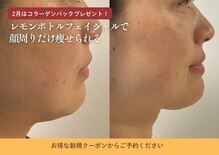 デディア 恵比寿(dedia)