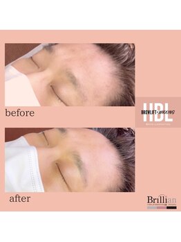 ブリリアン/男性【ハリウッドブロウリフト】