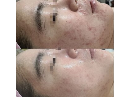 ケイビューティーサロン(K BeautySalon)の写真