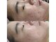 ケイビューティーサロン(K BeautySalon)の写真