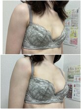 バーディー(BIRDIE)/施術１回/２０代