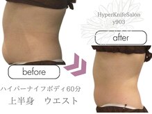 ワイキューマルサン(y903)/ハイパーナイフボディ60分上半身