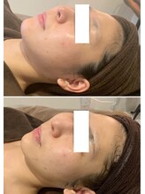 アネル 浦添店(anel)/