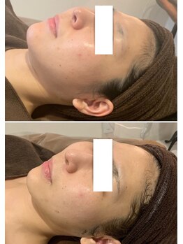 アネル 浦添店(anel)/