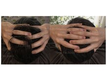 リボディ(Re.Body)/頭蓋骨すもーる術