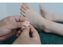 タイチ鍼灸接骨院/ハリが苦手な方へ