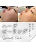 肌質改善★育肌ハーブピーリング★【剥離、痛み、ダウンタイムなし】6600円