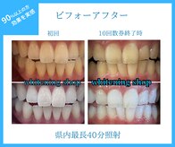 ホワイトニングショップ 山口店