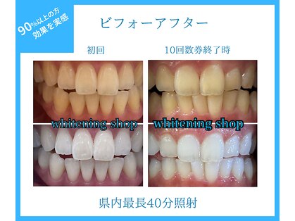 ホワイトニングショップ 山口店の写真