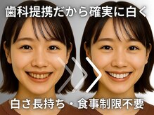 ホワイトニングセンター 大阪茨木店