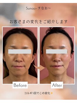 すなお 溝の口(Sunao)/【小顔コルギリンパ】40代お客様