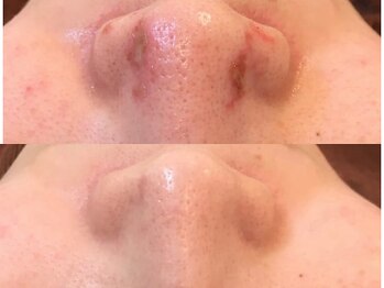 ポ ワール(Poir)/