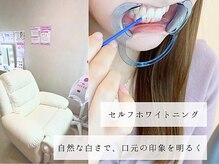 エクシアホワイトニング 碧南店の雰囲気（《セルフホワイトニング》強力な自社開発ジェルの美白成分使用!!）