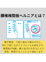 熊本カワル整体 JR上熊本駅院/腰の痛み