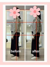 リスリム(Re:slim)/長年のコンプレックスお尻周り