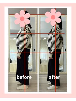 リスリム(Re:slim)/長年のコンプレックスお尻周り