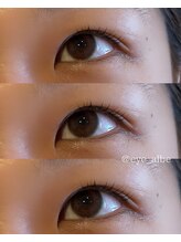 アルベ(albe)/まつ毛パーマ