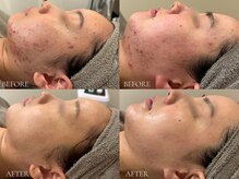 ベベ 表参道(bebe)の雰囲気（【必ずお肌は変わります】自分史上最高のお肌を目指しませんか？）