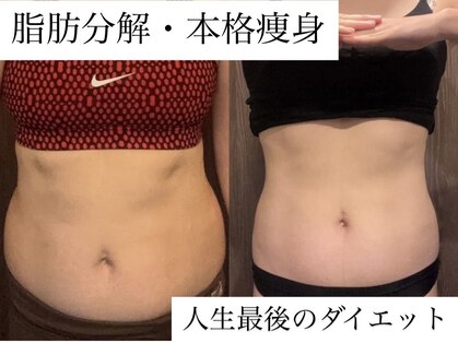 ジョーヌ(JAUNE)の写真