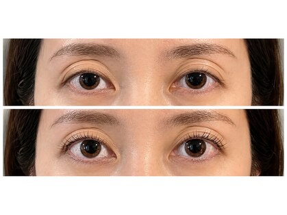ユリカゴ(Yurikago)の写真