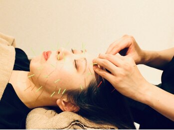 クマノミ美容鍼灸 川口院(KUMANOMI美容鍼灸)の写真/《小顔矯正と美容鍼で骨格&筋膜からリフトUP》独自の手技の小顔矯正と美容鍼をSETでご提供!土台から小さく!