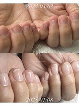 フィグ ツリー(fig tree)/深爪緩和care