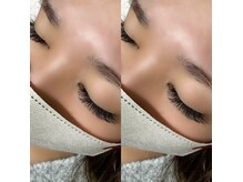 アアルズ(R’s)/