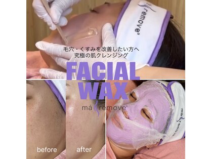 ビビッド(vivid)の写真