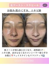 サロン 稲(SALON IIIINEE)/光ブースト