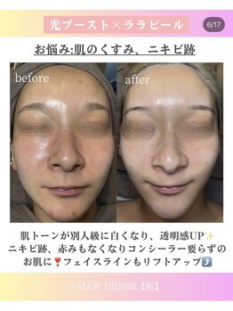 サロン 稲(SALON IIIINEE)/光ブースト