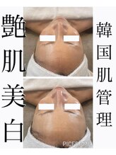 ジュエッテ(jouete)/圧倒的人気！水光白玉肌管理