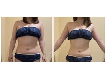 ソラウミ(SORAUMI)/美しくスタイル良く痩せる☆