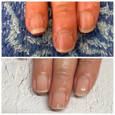 リジュビネイル(Rejuvenail)