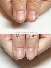 マリーロール 梅田店(Marie Laure)/深爪矯正/自爪育成/自爪風