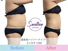 スワロウ(swallow)